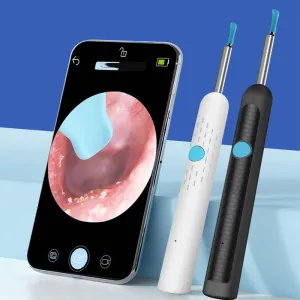 Ear Wax Removal Tool with Camera