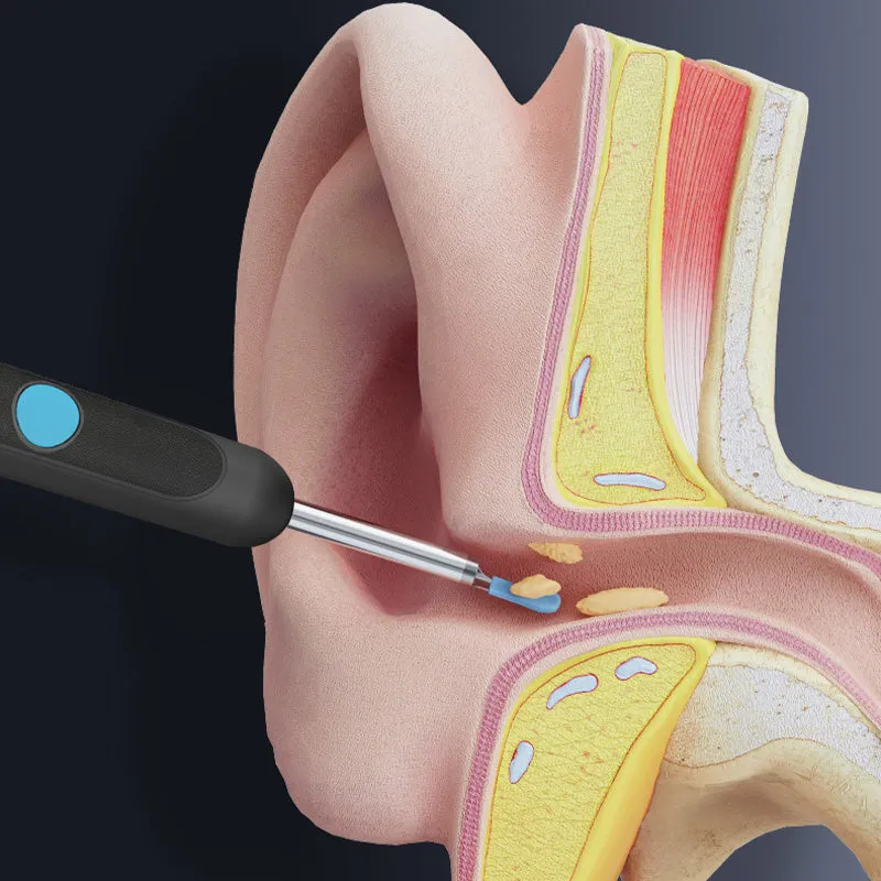 Ear Wax Removal Tool with Camera
